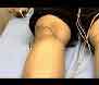 Autism Acupuncture, Autism Neuro Acupuncture, Autism Herbal Herbs, Autism Medicine, Autism Acupuncture Treatment Cure, Neuro Autism Acupuncture Centre
